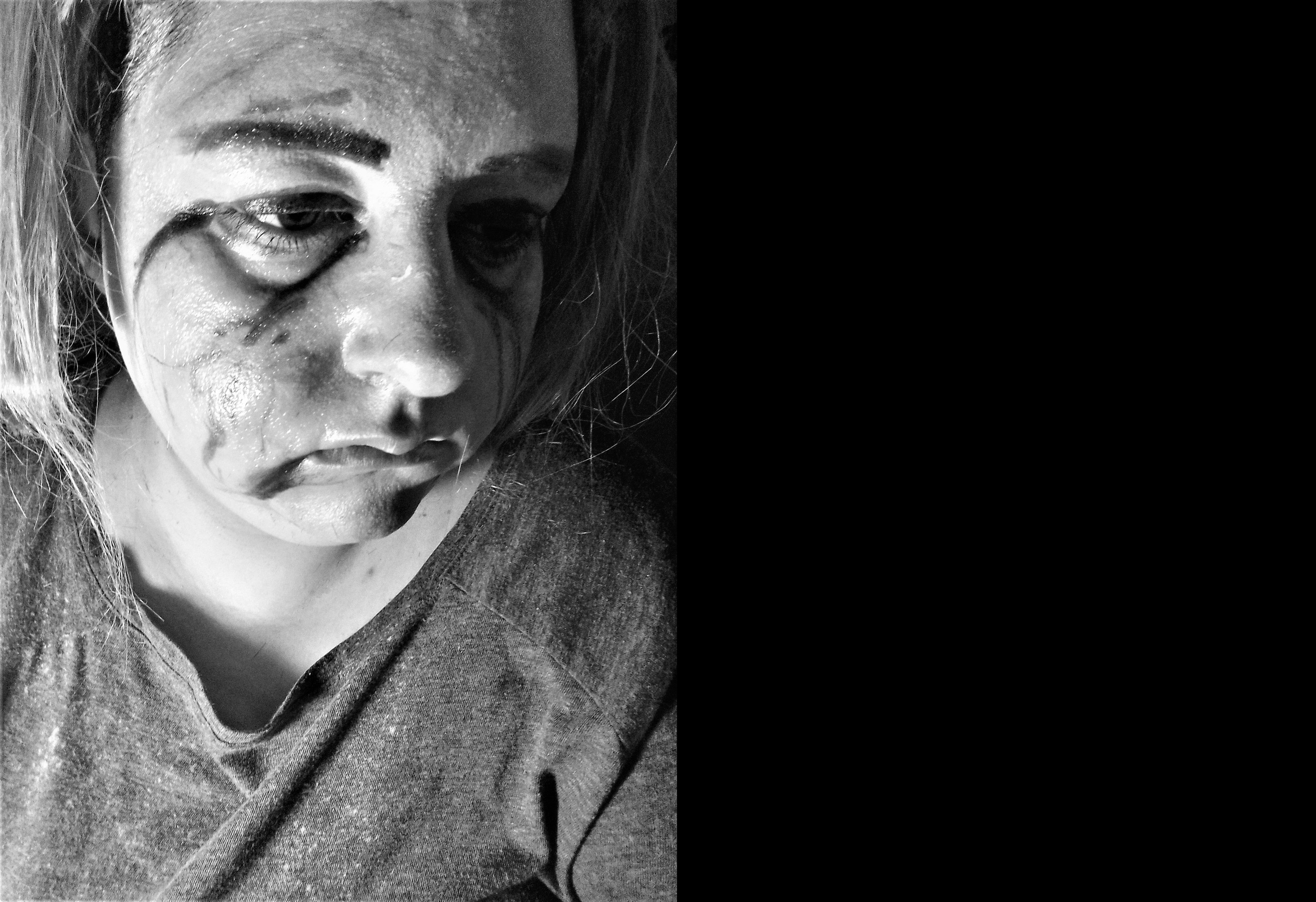 Schwarz-weiß-Foto einer Frau mit sichtbaren Gesichtsverletzungen, ernster Miene, konzentriertem Blick, zurückgebundenem Haar, trägt ein T-Shirt.